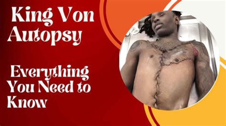Disturbing Autopsy Photos Of King Von's Fatal Shooting